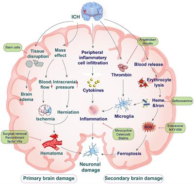 Therapeutic strategies for intracerebral hemorrhage